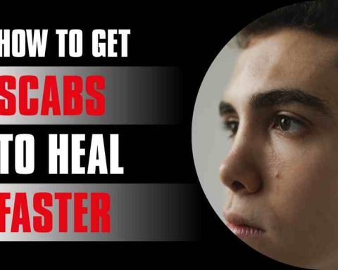 How To Get Scabs To Heal Faster