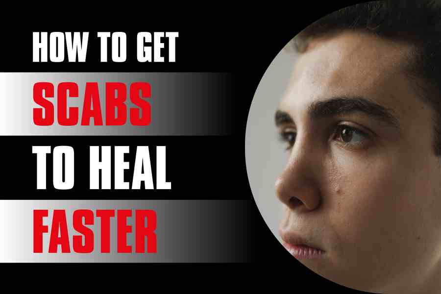 How To Get Scabs To Heal Faster